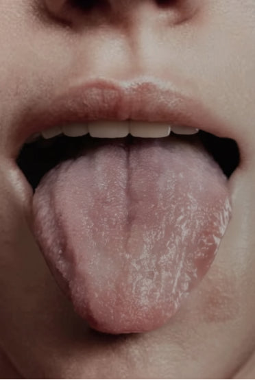 Tongue Analysis